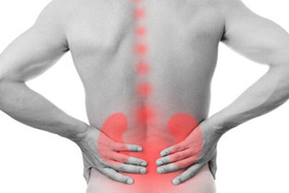 Kidney pathology can provoke the appearance of back pain