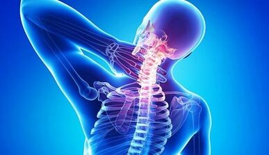 Symptoms and treatment of cervical osteocondrosis