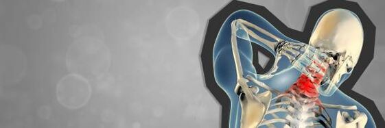 Osteocondrosis of cervical waist